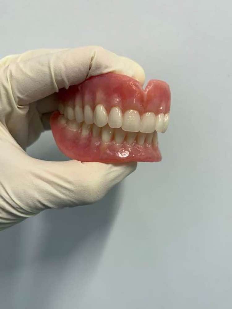 Full Dentures
