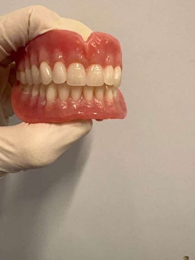 Custom denture fabrication process in on-site laboratory at Oak Park Dental Clinic Melbourne
