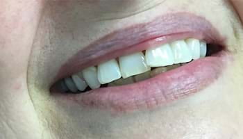 A lady showing invisible claps