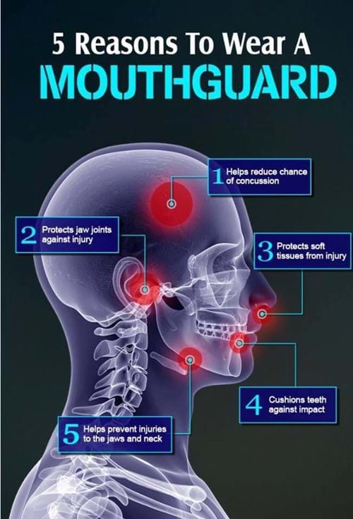 reason to wear mouthguard
