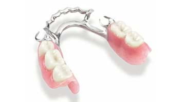 Image of chrome partial denture