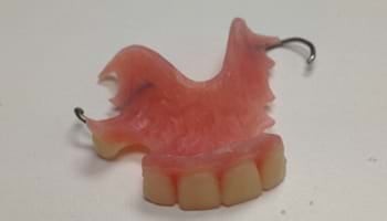 Image of acrylic Partial Denture