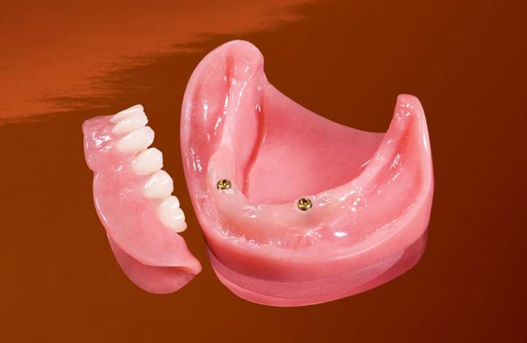 A fake Denture